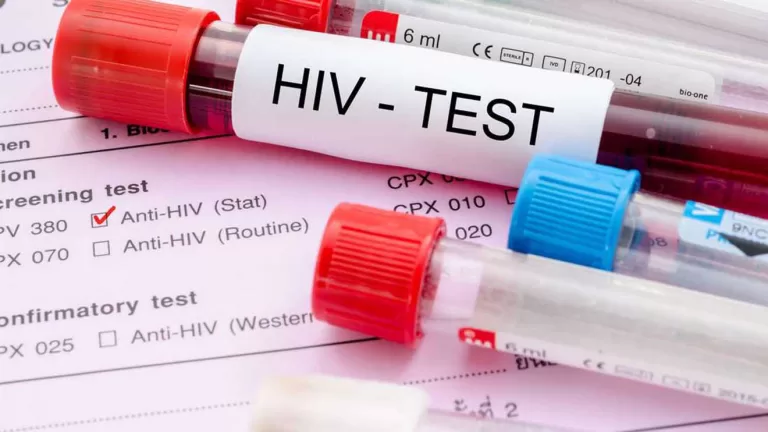 Improving HIV-infected women's health behind the science